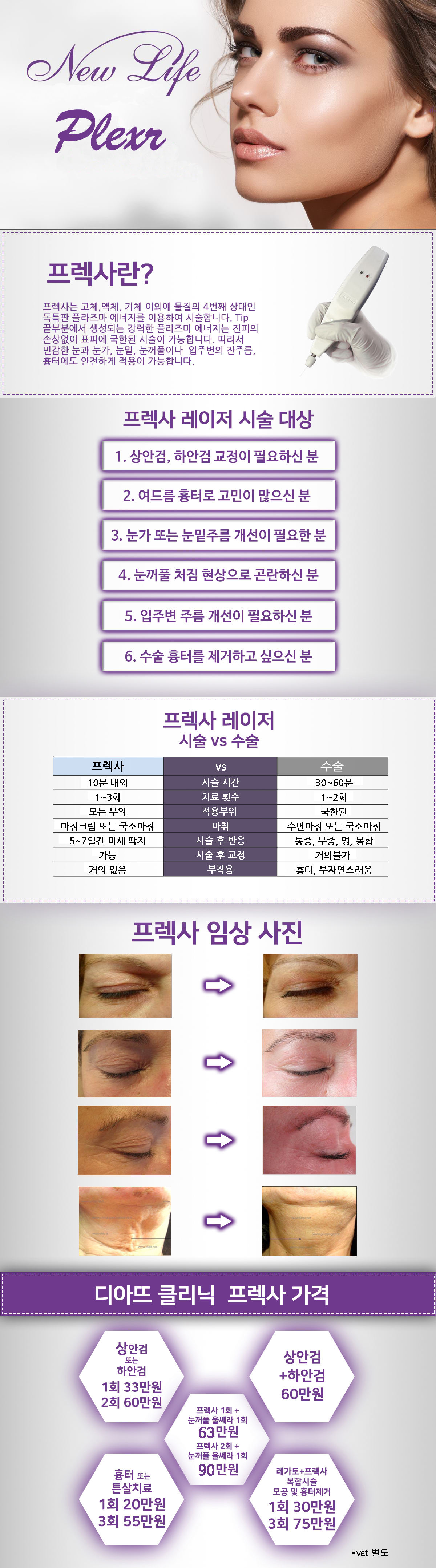 프렉사 대표 이미지 1